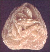 Kamień składający się z szczawianu wapnia wydobyty nerki pacjenta